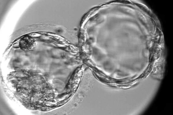PGT在海外代孕中的主要应用
