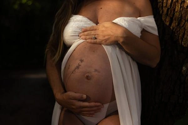 墨西哥代孕流程